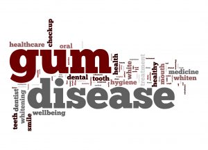 Gum Disease And The Point Of No Return