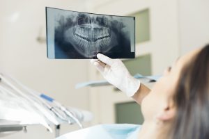 Is Teeth-Grinding Damaging Your Smile?
