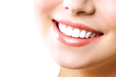 sheridan teeth whitening