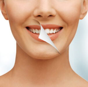 sheridan teeth whitening