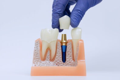 sheridan dental implants