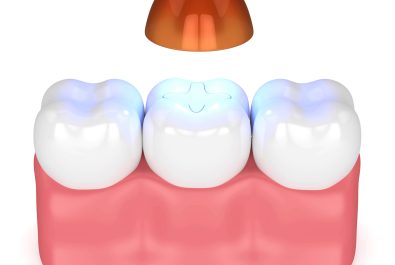 sheridan dental filling